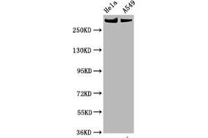 Western Blot Positive WB detected in Hela whole cell lysate,A549 whole cell lysate All lanes Phospho-MTOR antibody at 0. (Recombinant MTOR antibody  (pSer2448))