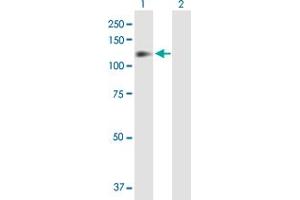 Western Blot analysis of ITGB1 expression in transfected 293T cell line by ITGB1 MaxPab polyclonal antibody. (ITGB1 antibody  (AA 1-798))