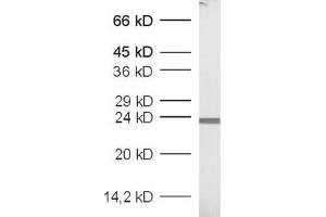 dilution: 1 : 1000, sample: recombinant protein (GFP antibody  (AA 183-191))