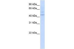 LAX1 antibody used at 1 ug/ml to detect target protein. (LAX1 antibody  (Middle Region))