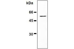 Western Blotting (WB) image for anti-Vimentin (VIM) antibody (ABIN1109487) (Vimentin antibody)