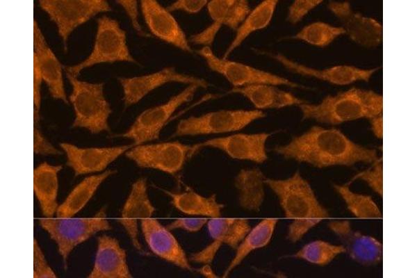 ZC3H7A antibody