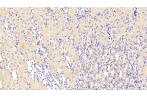 Detection of TMOD3 in Mouse Kidney Tissue using Polyclonal Antibody to Tropomodulin 3 (TMOD3) (TMOD3 antibody  (AA 1-352))