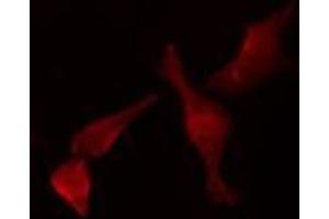 ABIN6277456 staining HeLa cells by IF/ICC. (SCTR antibody  (Internal Region))