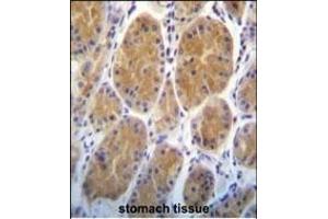 RS2 Antibody (Center) (ABIN391806 and ABIN2837974) immunohistochemistry analysis in formalin fixed and paraffin embedded human stomach tissue followed by peroxidase conjugation of the secondary antibody and DAB staining. (AARS2 antibody  (AA 366-394))