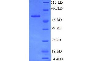 SDS-PAGE (SDS) image for Podocalyxin-Like (PODXL) (AA 32-458), (partial) protein (His tag) (ABIN1095725)