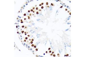 Immunohistochemistry of paraffin-embedded rat testis using PI+PI Rabbit mAb (ABIN7266879) at dilution of 1:100 (40x lens). (E3 SUMO-Protein Ligase PIAS3 (LOC101740849) antibody)