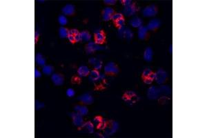 Staining of a cytospin preparation of peripheral blood mononuclear cells (PBMC) isolated from buffycoat. (Cathelicidin antibody)
