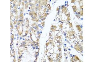 Immunohistochemistry of paraffin-embedded Human stomach using TNFAIP6 Polyclonal Antibody at dilution of 1:100 (40x lens). (TNFAIP6 antibody)