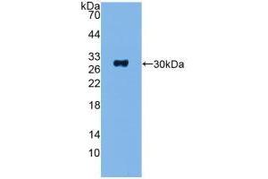 Western blot analysis of recombinant Human ADCY1. (ADCY1 antibody  (AA 835-1061))