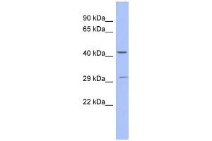 WB Suggested Anti-ZNF575 Antibody Titration:  0.