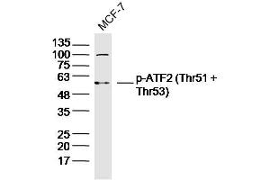 MCF-7 lysates probed with p-ATF2 (Thr51 + Thr53) Polyclonal Antibody, Unconjugated  at 1:300 dilution and 4˚C overnight incubation.