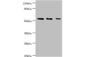 Western blot All lanes: TGF-beta-activated kinase 1 and MAP3K7-binding protein 1 antibody at 7 μg/mL Lane 1: K562 whole cell lysate Lane 2: Hela whole cell lysate Lane 3: Mouse heart tissue Secondary Goat polyclonal to rabbit IgG at 1/10000 dilution Predicted band size: 55, 50 kDa Observed band size: 55 kDa (TAB1 antibody  (AA 205-504))