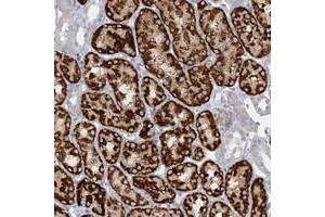 Immunohistochemical staining of human kidney with AGXT2 polyclonal antibody  shows strong cytoplasmic positivity in renal tubules at 1:50-1:200 dilution.