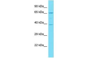 Host: Rabbit Target Name: C19orf67 Sample Type: Jurkat Whole Cell lysates Antibody Dilution: 1. (C19ORF67 antibody  (N-Term))