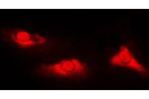 Immunofluorescent analysis of DJ-1 staining in Jurkat cells. (PARK7/DJ1 antibody  (Center))