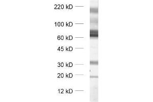 dilution: 1 : 1000, sample: synaptic membrane fraction (LP1) of rat brain (SLC1A3 antibody  (Cytoplasmic Domain))