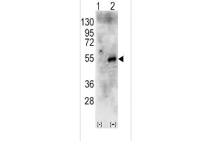 Western blot analysis of RPS6KB2 using rabbit polyclonal RPS6KB2 Antibody using 293 cell lysates (2 ug/lane) either nontransfected (Lane 1) or transiently transfected with the human RPS6KB2 gene (Lane 2). (RPS6KB2 antibody  (AA 243-272))