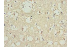 Immunohistochemistry of paraffin-embedded human brain tissue using ABIN7163186 at dilution of 1:100 (PIP5K1B antibody  (AA 190-470))
