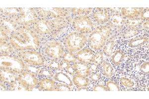 Detection of ALT in Human Kidney Tissue using Monoclonal Antibody to Alanine Aminotransferase (ALT) (ALT antibody  (AA 255-492))