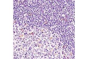 BTK antibody immunohistochemistry analysis in formalin fixed and paraffin embedded human tonsil tissue. (BTK antibody  (AA 27-55))