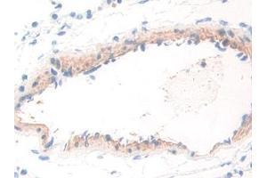 DAB staining on IHC-P; Samples: Rat Lung Tissue (WARS antibody  (AA 140-347))