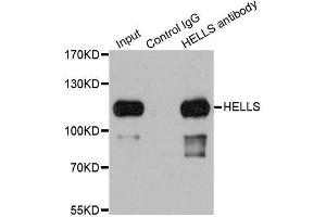 Immunoprecipitation analysis of 200ug extracts of 293T cells using 1ug HELLS antibody. (HELLS antibody  (AA 719-838))