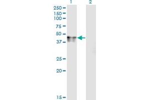 CANT1 antibody  (AA 302-401)