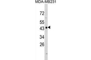 Western blot analysis of NDRG1 Antibody (N-term) in MDA-MB231 cell line lysates (35ug/lane). (NDRG1 antibody  (N-Term))