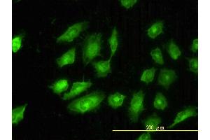 Immunofluorescence of monoclonal antibody to TPM4 on HeLa cell.