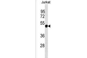 NXF5 Antibody (N-term) (ABIN1539447 and ABIN2849866) western blot analysis in Jurkat cell line lysates (35 μg/lane).