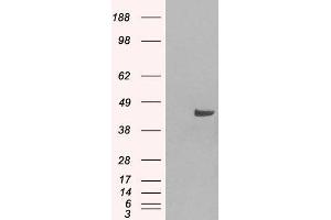 HEK293 overexpressing SNX16 (ABIN5364935) and probed with ABIN184967 (mock transfection in first lane). (SNX16 antibody  (N-Term))