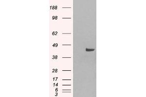 HEK293 overexpressing SNX16 (ABIN5364935) and probed with ABIN184967 (mock transfection in first lane). (SNX16 antibody  (N-Term))