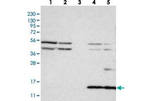Western blot analysis of Lane 1: RT-4, Lane 2: U-251 MG, Lane 3: Human Plasma, Lane 4: Liver, Lane 5: Tonsil with CYB561D1 polyclonal antibody . (CYB561D1 antibody)