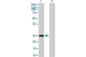 Western Blot analysis of HSPB8 expression in transfected 293T cell line by HSPB8 monoclonal antibody (M02), clone 5D7. (HSPB8 antibody  (AA 97-196))