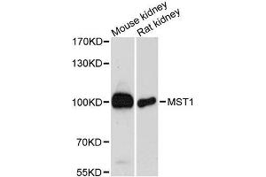 Western blot analysis of extracts of various cell lines, using MST1 antibody. (MST1 antibody  (AA 200-500))