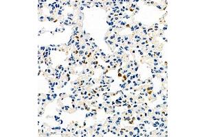 Immunohistochemistry of paraffin embedded mouse pneumonia using CCL3 (ABIN7073450) at dilution of 1:1000 (400x lens) (CCL3 antibody)