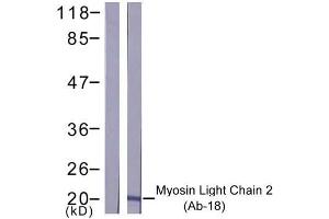 Western blot analysis of extract from K562 cells, using Myosin Light Chain 2 (Ab-18) antibody (E021157). (Myosin antibody)