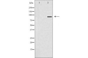 Western blot analysis of SOX6 Antibody expression in Hela cells lysates. (SOX6 antibody  (N-Term))