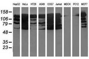 Image no. 1 for anti-Budding Uninhibited By Benzimidazoles 1 Homolog beta (Yeast) (BUB1B) antibody (ABIN1496997) (BUB1B antibody)