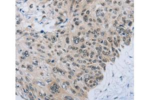 Immunohistochemistry (IHC) image for anti-Solute Carrier Family 16 (Monocarboxylic Acid Transporters), Member 4 (SLC16A4) (AA 250-350) antibody (ABIN1682735) (SLC16A4 antibody  (AA 250-350))
