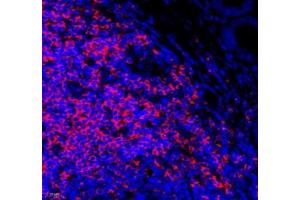Immunofluorescence (Paraffin-embedded Sections) (IF (p)) image for anti-Linker For Activation of T Cells (LAT) antibody (ABIN7074502)