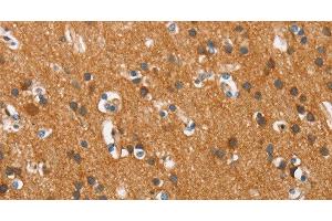Immunohistochemistry of paraffin-embedded Human brain tissue using COX5A Polyclonal Antibody at dilution 1:40 (COX5A antibody)