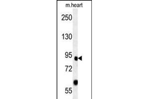 FOXP2 Antikörper  (AA 657-684)