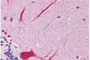 Human Brain, Cerebellum: Formalin-Fixed, Paraffin-Embedded (FFPE) (PTPN11 antibody  (AA 584-597))