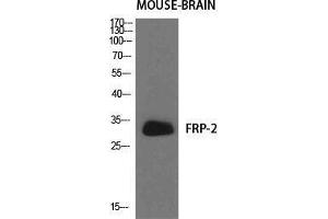 Western Blot (WB) analysis of specific cells using FRP-2 Polyclonal Antibody. (SFRP2 antibody  (Internal Region))