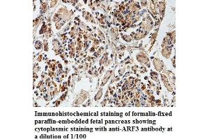 Image no. 1 for anti-ADP-Ribosylation Factor 3 (ARF3) antibody (ABIN1574780) (ARF3 antibody)