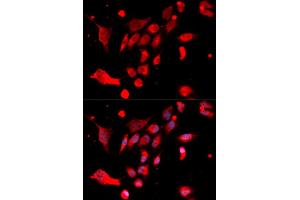 Immunofluorescence analysis of U2OS cells using MAD2L1 antibody (ABIN5970848). (MAD2L1 antibody)