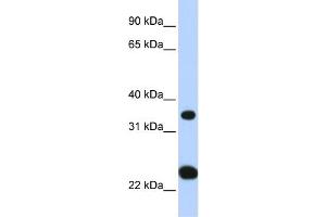 WB Suggested Anti-SLC25A35 Antibody Titration:  0. (SLC25A35 antibody  (N-Term))