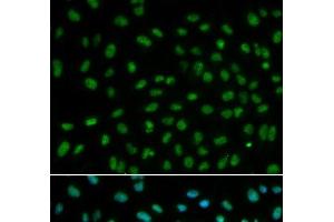 Immunofluorescence analysis of MCF-7 cells using DDB2 Polyclonal Antibody (DDB2 antibody)